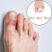 14 PCS Hammer Toe Straightener with Toe Ring Design - Correct Crooked Toes, Overlapping Toes - Ideal for Daily Wear & Exercise - Buy Online on GoSupps.com
