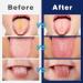 Probiotic Tongue Coating Cleaning Gel Set - 3PCS Tongue Scraper & Silicone Brush for Precise Oral Hygiene - Shop Internationally - Buy Online on GoSupps.com