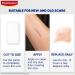 Elastoplast Scar Reducer Plasters - 21 Patches for Quick Results - Clear Skin Treatment - Buy Online on GoSupps.com