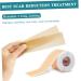 Silicone Gel Scar Patch Roll for Scar Removal & Wound Care - Lighten Scars & Desalinate, 1 Roll - Buy Online on GoSupps.com
