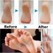 TOSSPER 5pcs Foot Exfoliator Remover - Replacement Roller Tool for Smooth Feet | Best Foot Care Solution - Buy Online on GoSupps.com