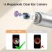 Ear Wax Removal Kit with 1080p Otoscope - Bebird X17pro Ear Cleaning Tool with 9 Ear Picks - Compatible with iPhone & Android (Gold) - Buy Online on GoSupps.com