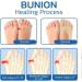 2023 Ergoic Anti-Bunions Health Socks - 5 Pairs - Toe Alignment for Bunions - Apricot - Buy Online on GoSupps.com