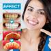 Miyanxi Tooth Powder - Effective Whitening for Coffee & Smoke Stains | 50g Box | International Shipping - Buy Online on GoSupps.com