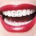 Tooth Crystals - 4pcs Tartar Tooth Decorations | DIY Gemstone & Rhinestone Ornaments for Nail & Teeth Decor - Buy Online on GoSupps.com