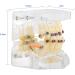 Orthodontic Treatment Weikeya Model | Harz Group PVC Teeth Learning - International Shipping Available - Buy Online on GoSupps.com