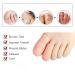 Toe Cushion Hose - 8 Pairs of Angrek Toe Caps for Big Toe Pain Relief & Friction Protection | Ideal for Chicken Eye Bubbles - Buy Online on GoSupps.com