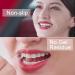 Teeth Whitening Strips for Sensitive Teeth Peroxide Free & Enamel Safe | 14 Professional Whitening Strips - Buy Online on GoSupps.com