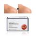 Scar Removal Cream 15Pcs - Cover, Reduce & Care for Old Scars & Scald with Connective Tissue Reduction - Buy Online on GoSupps.com