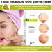 TIS Pharmaceutical TIS Sulfur 7 Cream For Oily Acne Seborrheic Skin Care Removes Skin Seborrheic Flakes Exfoliating Properties Face and Body Unisex - Buy Online on GoSupps.com
