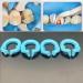 4pcs Dental Resin Clamping Ring Separator Ring Sectional Contoured Metal Matrices Holder Fixed Clamp - Buy Online on GoSupps.com