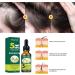 dijiusidy Ginger Hair Growth Oil Prevent Baldness Good-absorption Fast Growing 30MLSerum Nourish Tools Female - Buy Online on GoSupps.com