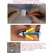 3 Pack Soft Contact Lens Insertion & Removal Tools | Portable Silicone Rubber Eye Lens Device | Safe & Easy Travel Size - Buy Online on GoSupps.com