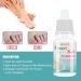 Mify 10ml Nail Fungus Treatment | Nail & Toenail Care Liquid | Fast-Acting Foot Care Solution - Buy Online on GoSupps.com