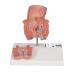 3B Scientific K27 Hemorrhoid Model - 3B Smart Anatomy