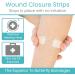 Buy ViveCare Emergency Wound Closure Device Kit 4 Pcs Adhesive Zip Stitch Sutures & Sterile Bandaids for Outdoors | Laceration Closure Without Stitches - Buy Online on GoSupps.com