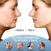 Double Chin Reducer & V Line Lifting Mask - Elastic Face Slimming Belt & Silicone Chin Strap for Women - Facelift & Chin Lift Solutions - Buy Online on GoSupps.com
