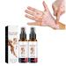DUBUSH Vitiligo Kalmerende Spray Vitiligo Skin Repair Spray