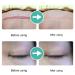 SILICONE SCAR SHEETS | Professional Gel Patch for Scar Removal, Stretch Marks, Keloids | C-Section & Stomach Pads for Men & Women - Skin Care Stickers - Buy Online on GoSupps.com