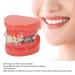 Buy GFRGFH Dental Model with 24 Teeth - Half Metal Half Ceramic Bracket for Teaching & Study - International Shipping Available - Buy Online on GoSupps.com