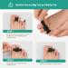 Welnove Hammer Toe Straightener - 8 Pack Cushioned Splints for Overlapping & Crooked Toes - Large Black Toe Corrector & Bandages - Buy Online on GoSupps.com