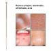 Blackhead Remover Whitehead Acne Removal Stainless Steel Pimple Popper Extractor Tool Portable Acne Removal Tool - Buy Online on GoSupps.com