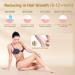 IPL Laser Hair Removal Device for Men & Women - 5 Energy Levels for Face Arms Legs & More - Buy Online on GoSupps.com
