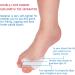 Yuyte 9pcs Gel Toe Separator & Ankle Correction Device - Comfort & Pain Relief - Buy Online on GoSupps.com