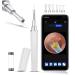 Ear Wax Removal Tool  Ear Wax Removal Ear Camera  Earwax Removal Kit with 6 Ear Pick 1296P Hd Ear Cleaning Kit with Light  Ear Wax Cleaner Tool for iPhone  iPad  Android Phones(White)