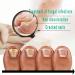 Kerassentials Toenail Fungus Treatment Oil Best Repair Solution for Fingernails and Toenails Fix & Renew Damage Fungal Nail Broken Cracked & Discolored Nails - Buy Online on GoSupps.com