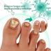 KYOSK Kerassentials Toenail Fungus Treatment Oil Kerassentials for Toenail Fungus Kerasentials Nail Treatment Repair Oil Fix & Renew Damage Nail Broken Cracked & Discolored Nails (6pcs) - Buy Online on GoSupps.com