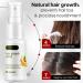 AZIDWERYQ Hair Growth Serum Spray Hair Growth Accelerator Wild Growth Hair Ginger Oil for Hair Loss Treatments 20ML hair loss treatments - Buy Online on GoSupps.com