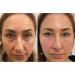 Ceoerty EyeGlo Bee Venom Collagen Eye Cream Advanced Anti Aging Eye Cream Sporty EyeGlo Bee Venom Collagen Eye Cream For Dark Circles Puffiness & Bags Reduce Wrinkles Fine Lines (2 Pack) - Buy Online on GoSupps.com