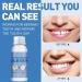 Temporary Dental Repair Beads - Fast Denture Fix for Missing & Broken Teeth Degradable Tooth Filling Material (30g) - Buy Online on GoSupps.com