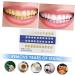 Mobestech 5 Sets 20pcs Tooth Color Card Label - PVC Dental Tools for Oral Care | International Shipping Available - Buy Online on GoSupps.com