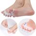 zoerbufan Toe Separators 3 Pair Toe Stretcher for Overlapping Toes to Relax Toes Silicone Toe Straighteners for Hallux Valgus Soft Gel Toe Spacers for Correct Bunions (Transparent) - Buy Online on GoSupps.com