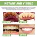 Ampoule Toothpaste & Serum - 3V Fruit Acid Tooth Whitening Essence | International Shipping Available - Buy Online on GoSupps.com