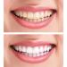 Professional 27 Colors Teeth Whitening Shade Guide Box for Precise Color Comparison - Buy Online on GoSupps.com