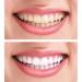 27 Colors Teeth Whitening Shade Guide - Professional Dental Bleaching Chart for Home & Salon Use - Buy Online on GoSupps.com