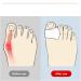 ALINZO Bunion Corrector & Relief Sleeve with Gel Pads - 1 Pair for Big Toe Pain Relief & Realignment- Men & Women - Buy Online on GoSupps.com