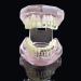 LBYLYH Orthodontic Demonstration Model - Teeth Teaching Tools with Metal & Ceramic Support for Effective Dental Treatment - Buy Online on GoSupps.com