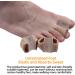 Soft and Skin-Friendly Toe Straightener with Double Orifice Design - Relieve Foot Pain, Overlapping Hallux Valgus, Hammer Toe - Medium 1 Pair - Buy Online on GoSupps.com