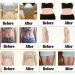Mugwort Belly Button Patch (60PCS) - Natural Plant for Men and Women - White - Buy Online on GoSupps.com