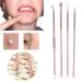 pimple extractor 4PCS/SET Blackhead Removal Tool Pimple Cleansing Tool Kit Stainless Steel Acne Pimple Extractor Acne Remover Tool With Box(Rose Gold) - Buy Online on GoSupps.com