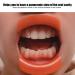 3pcs O-Shape Lip Retractor Opener - Enhance Oral Care with Mouth Cheek Lip Accessories for Dental Procedures - Buy Online on GoSupps.com