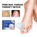 Furzero Nail Fungus Laser Treatment Device | Effective Laser Therapy for Nail Fungus - Buy Online on GoSupps.com