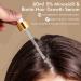 5% Minoxidil & Biotin Hair Growth Serum - 60ML for Men and Women | Hair Regrowth Treatment for Thicker, Longer, Healthier Hair | Prevent Scalp Hair Loss | Natural Formula for Fuller Hair - Buy Online on GoSupps.com