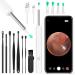 ACWOO Ear Wax Remover 1296P HD Wireless Ear Wax Removal Kit with Camera Visual Ear Otoscope Ear Cleaner with 6 LED Lights Smart Ear Wax Cleaner Tool for Adults Kids & Pets White
