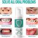 Teeth Total Care Mouthwash - 2025 Best Whitening & Refreshing Foam for All Oral Problems (60 ml 2PCs) - Buy Online on GoSupps.com