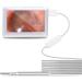 Ear Endoscope 3.9mm Ear Otoscope with 4.3 Inch Screen Support Photo Snap Video Recording Ear Inspection Tool Set Display